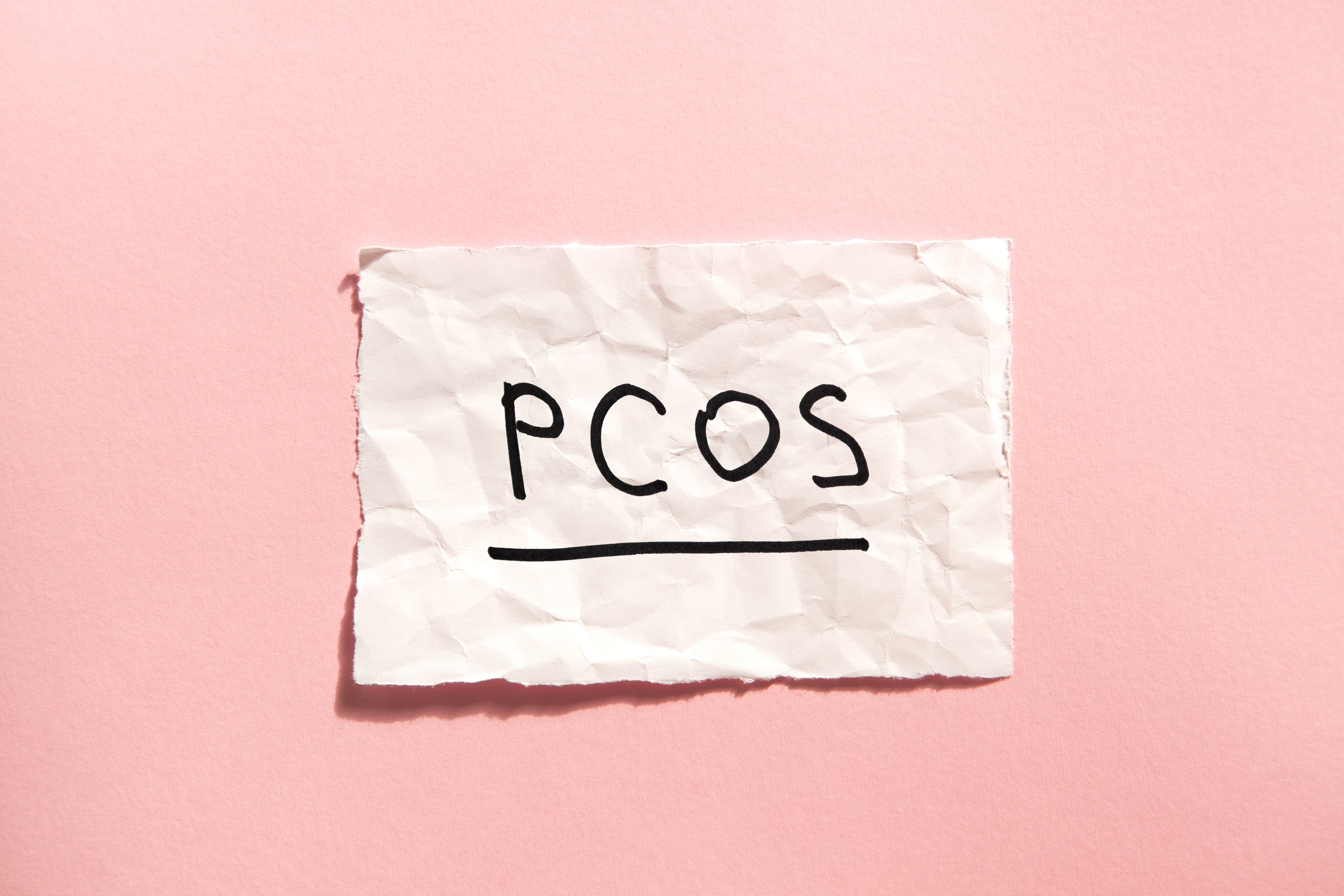 Laser and PCOS